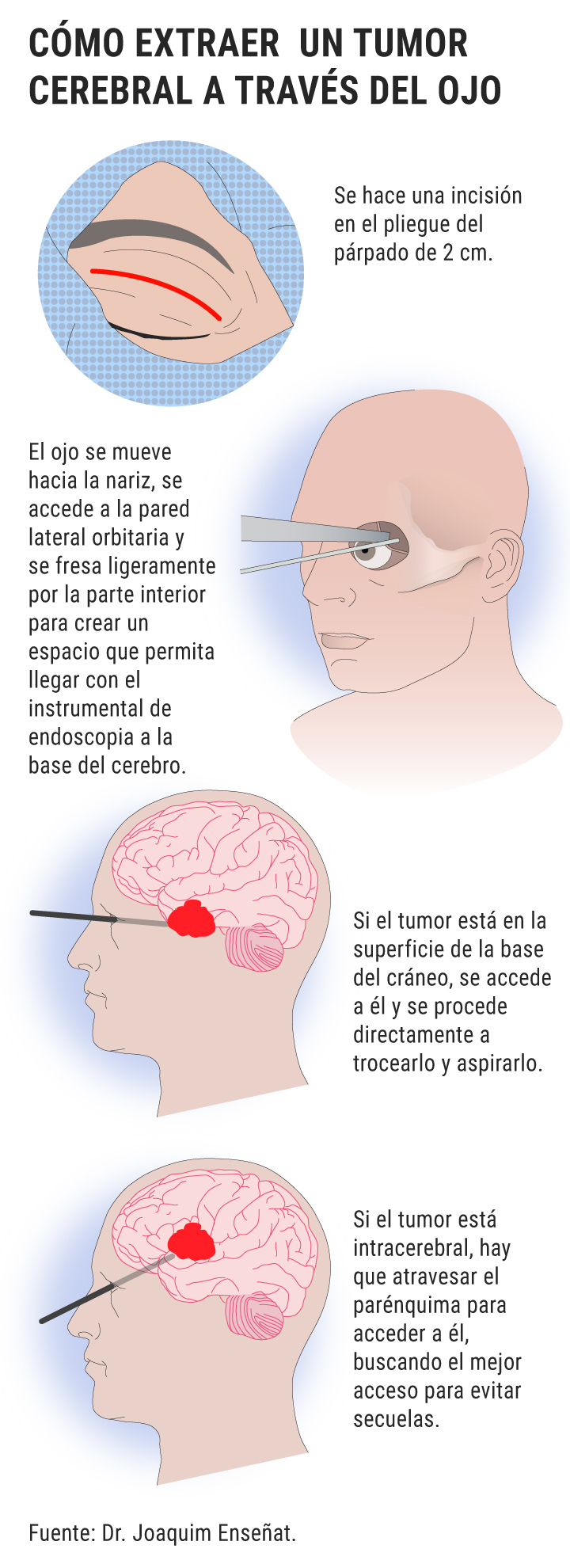 InfografÃa: DINA SÃNCHEZ.